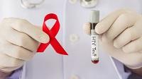 Эпидемиологическая ситуация по ВИЧ-инфекции в области
